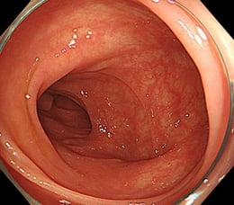 colon-normal-1